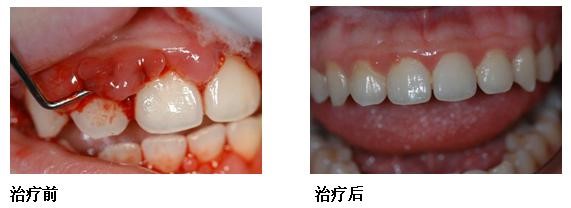 口腔科普2.jpg