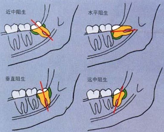 口腔科普5.jpg
