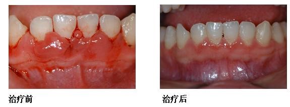口腔科普3.jpg